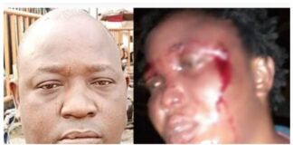 Man Arrested For Up Beating His Wife (See Photos) Man
