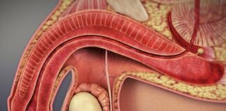 Seek Help When Erection Fails Eraction