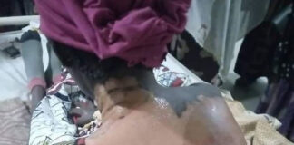 Woman Pours Hot Water On Her Co-wife And 4-year-old Stepdaughter In Kano Woman Pours Hot Water On Her Co-wife And 4-year-old Stepdaughter In Kano